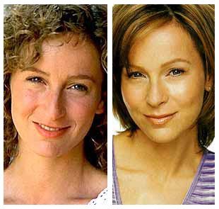 jennifer-grey-plastic-surgery